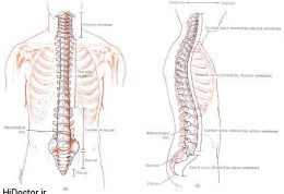ضعیفی بدن منشا ایجاد دیسک کمر