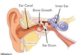 ضرورت رفع آب درون گوش