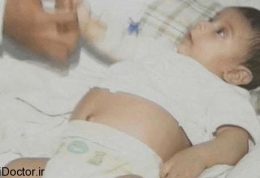 طفلی که باردار به دنیا آمد!
