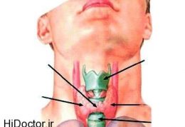 تمام اطلاعات لازم در مورد تیروئیدیت