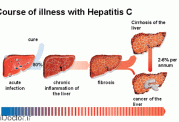 عوامل منتقل کننده ویروس هپاتیت c