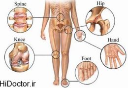 همه انواع دردها و اطلاعاتی راجع به آنان