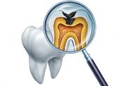  انتظارات ما از خمیر دندان چیست؟