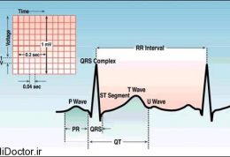 معیارهای اندازه گیری در نوار قلبی را یاد بگیرید