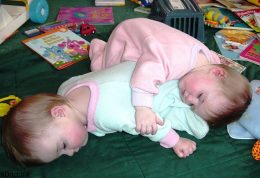 چطوری مشکلات  متداول نوزادان دوقلو را بدانیم