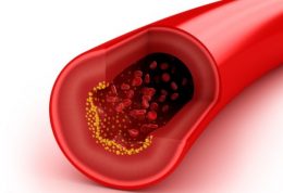 با مصرف فروکتوز چربی خون افزایش میابد