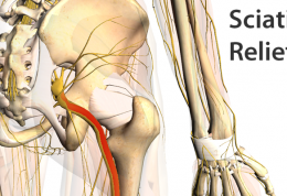 به دانستنی هایتان درمورد سیاتیک بیافزایید
