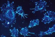 تخریب سلولهای سرطانزا با امواج صدا