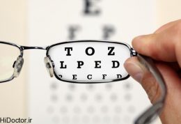 7 مورد برای  طولانی کردن عمر عینک