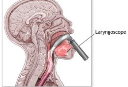 لارینگوسکوپ چه معنا و  استفاده هایی دارد؟