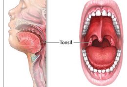 عضو دفاعی در بدن به نام لوزه