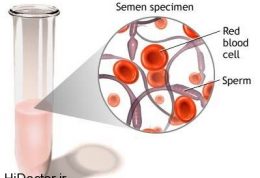 مشکل در مایع منی