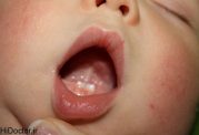 چه علائمی خبر از رشد اولین دندان بچه می دهند