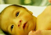 عوارض زردی و یرقان در نوزاد