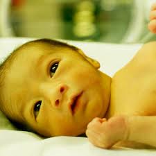 عوارض زردی و یرقان در نوزاد