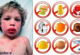 عواقب آلرژیک از نوع خوراکی در اطفال