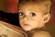 علت ابتلا به سوء تغذیه در اطفال