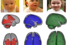 روند رشد مغز نوزاد با والدین معتاد
