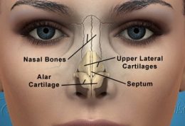انحراف بینی چگونه ایجاد میشود