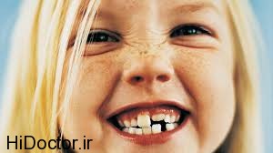 آمار بالای مشکلات مربوط به دهان و دندان اطفال