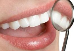 ماندگار کردن شفافیت دندان