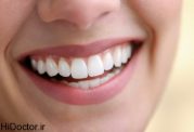 ماده ای مفید و پرخاصیت برای دندان ها
