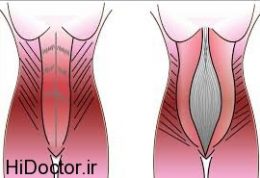 مناسب ترین حرکات برای کاهش سایز شکم تازه مادرها