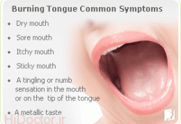 از سندرم سوزش زبان چه می دانید