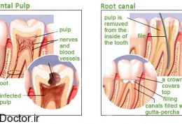 مطالبی پیرامون دندانپزشکی بیولوژیک