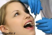 از بین رفتن دندان با مشکلات عصبی