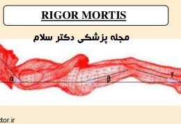 جمود نعشی و تغییرات جسد پس از مرگ