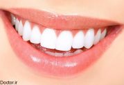10 نکته برای سالم نگه داشتن دندان ها