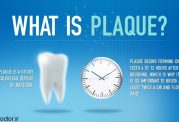 توصیه دندانپزشکی برای ایجاد پلاک دندان