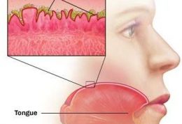 سلامت و بهداشت بیشتر دهان با کنار گذاشتن این مواد غذایی