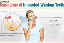 مهمترین اطلاعات لازم در مورد دندان عقل
