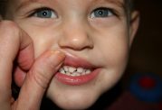 مشکلات دندانی در کودکان