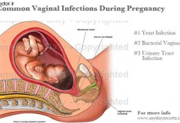 چگونه می توان عفونت در بارداری را کنترل کرد