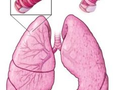 شرح مختصری راجع به  انواع درمانهای بیماری آسم
