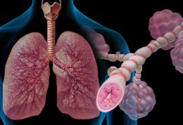 حساسیت و عوامل تحریک کننده آسم