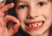 هنگام شکستگی دندان کودک چه کنیم؟