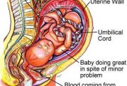 خطرات خونریزی از رحم برای جنین و مادر
