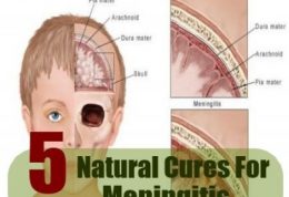 5 درمان طبیعی برای مننژیت