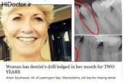 جنجال این خبر دندانپزشکی!