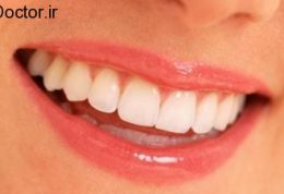 عوامل آسیب رسان به دندان