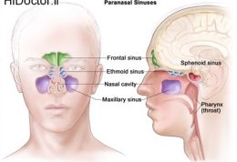 مبتلا شدن به سینوزیت با این کار