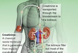 همه اطلاعات مورد نیاز شما درموردکراتینین