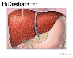 کبد بدنسازان در خطر است!