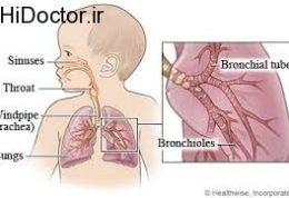 علت اکثر عارضه های تنفسی در طفال