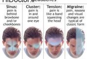 نقاط مختلف سر و صورت در مواجهه با انواع سر درد ها