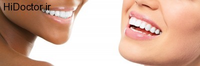 تفاوت های میان دو روش جلا دادن دندان